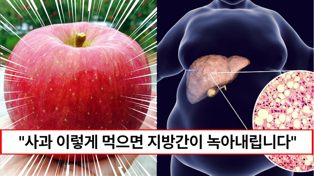 “위험한 지방간 방치하면 간암이 됩니다” 간에 낀 지방을 뺄 수 있는 최고의 사과 섭취법