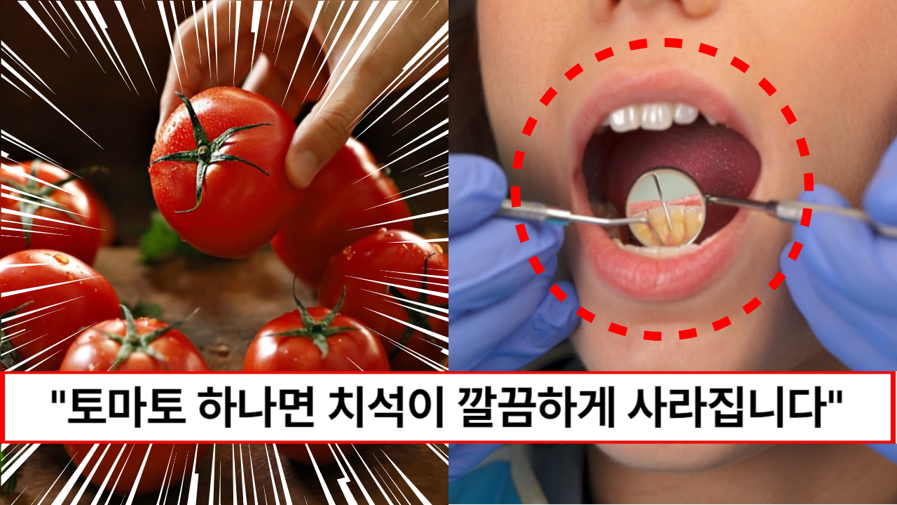 "토마토 하나면 치석이 떨어져 나갑니다" 치아와 잇몸 건강을 위협하는 치석제거에 좋은 음식 3가지